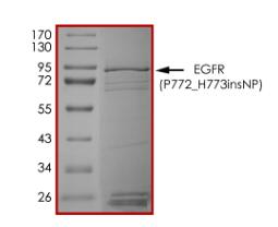 The purity of EGFR (P772_H773insNP) was determined to be >70 % by densitometry.